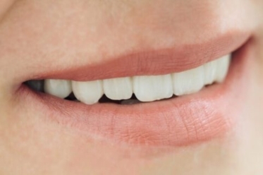 A woman's radiant smile with white teeth captured in Scottsdale, AZ.