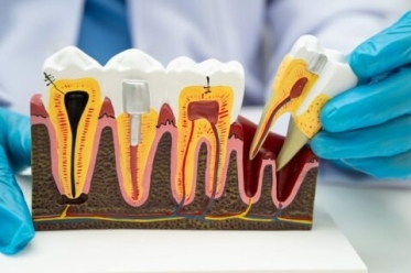 A close-up of a model of teeth