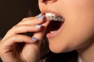 A close-up of a person putting in a mouthguard